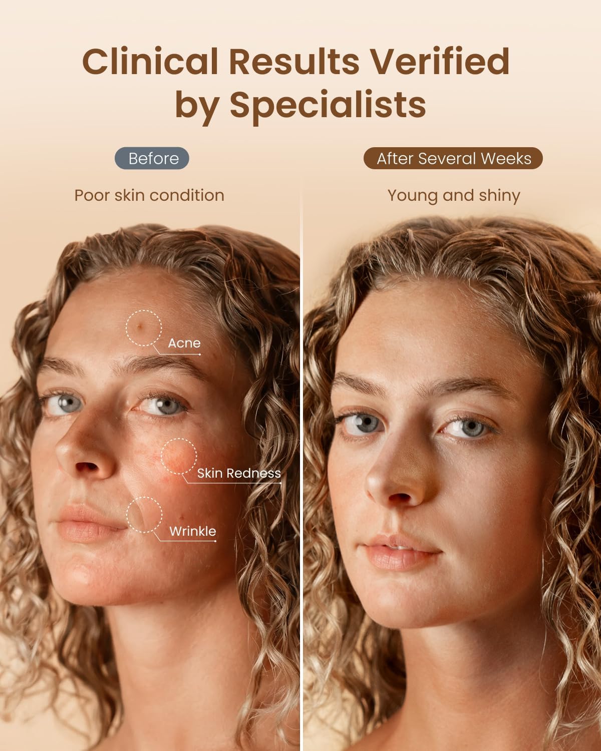 4D Red Light Therapy Mask for Face, 324 Leds Full Face Coverage & 3 Light Modes